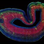 Study: Scientists solve the case of the missing subplate, with wide implications for brain science — (Details)