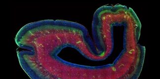 Study: Scientists solve the case of the missing subplate, with wide implications for brain science — (Details)