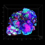 Study: A new tactic for starving tumors — (Details)