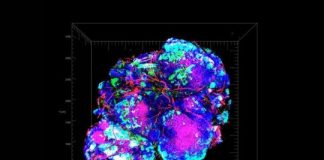 Study: A new tactic for starving tumors — (Details)