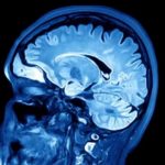 Herpes virus may play role in Alzheimer’s, says new research Herpes virus may play role in Alzheimer's, says new research