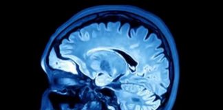 Herpes virus may play role in Alzheimer’s, says new research Herpes virus may play role in Alzheimer's, says new research