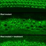 Study: Researchers shed light on molecular mechanisms of inherited form of human deafness — (Details)