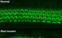 Study: Researchers shed light on molecular mechanisms of inherited form of human deafness — (Details)