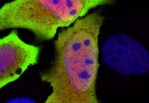 Research: Gene discovery unlocks mysteries to our immunity —