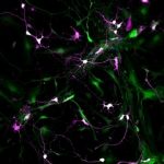 Study: Researchers of the Mainz University Medical Center publish new findings in the field of neuroregeneration in Nature Neuroscience — (Details)