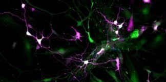 Study: Researchers of the Mainz University Medical Center publish new findings in the field of neuroregeneration in Nature Neuroscience — (Details)