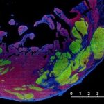 Study: Results suggest an approach that could be tested for treating people with heart failure — (Details)