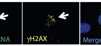Study: Scientists discover how satellite RNA leads to cancer — (Details)