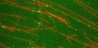 Study: Research team reconstructs motor-cargo complex for ciliary transport — (Details)