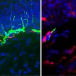 Study: Investigational drug works differently than addictive opioid drugs — (Details)