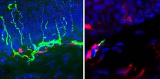 Study: Investigational drug works differently than addictive opioid drugs — (Details)