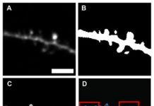 Tech: New software designed for rapid, automated identification of dendritic spines — (Report)