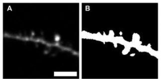 Tech: New software designed for rapid, automated identification of dendritic spines — (Report)