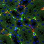 Study: Discovery may lead to improved treatment for chronic kidney disease — (Details)