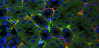 Study: Discovery may lead to improved treatment for chronic kidney disease — (Details)