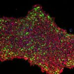 Study: New method for turning skin cells into pluripotent stem cells — (Details)