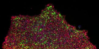 Study: New method for turning skin cells into pluripotent stem cells — (Details)