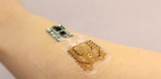 Tech: Bandages with integrated pH and temperature sensors and electronically triggered drug release are designed to improve healing — (Report)