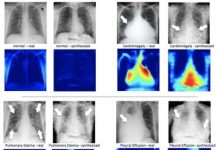 Tech: New research could help AI identify rare conditions in medical images by augmenting existing datasets — (Report)