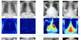 Tech: New research could help AI identify rare conditions in medical images by augmenting existing datasets — (Report)