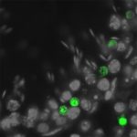 Study: Protein function repairing genetic damage in spermatogenesis identified — (Details)