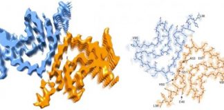 Study: How does Parkinson’s disease develop? Study raises doubts on theory of Parkinson’s disease — (Details)