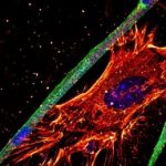 Study: Essential mechanism to generate healthy muscle — (Details)