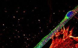 Study: Essential mechanism to generate healthy muscle — (Details)