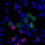 Study: Simple test to predict rare cancers’ likely spread — (Details)