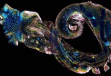Research: Finding a weak link in the frightful parasite Schistosoma —