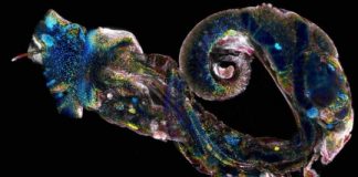 Research: Finding a weak link in the frightful parasite Schistosoma —