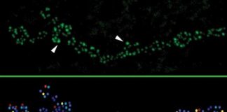 Study: What separates the strong from weak among connections in the brain — (Details)