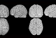 Research: Every person has a unique brain anatomy —