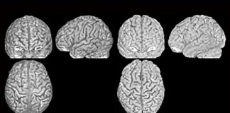 Research: Every person has a unique brain anatomy —