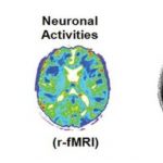 Study: Technique can be used to better categorize patients with neurological disease, according to their therapeutic needs — (Details)