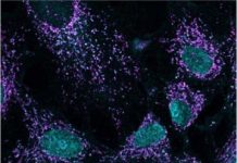 Research: Study clarifies dual role of protein that watches for cellular threats and repairs damage —