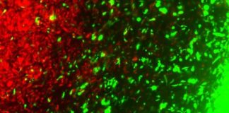 Study: CRISPR-enhanced, reverse-engineered cancer cells with a ‘kill switch’ can home in on and destroy tumors — (Details)