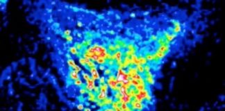 Research: Deep in the fly brain, a clue to how evolution changes minds —