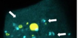 Study: Scientists create nano-size packets of genetic code aimed at brain cancer ‘seed’ cells — (Details)