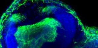 Study: Study shows we may want to think twice before attacking ROS — (Details)