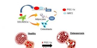 Study: Findings open up possibilities for new therapies to treat osteoporosis and skeletal aging — (Details)