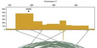 Study: Massive genome havoc in breast cancer is revealed — (Details)