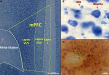 Research: Findings demonstrate long-term influence of endocrine-disrupting compounds on brain development —