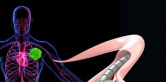 Study: Magnetized wire could be used to detect cancer in people — (Details)