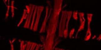 Research: High vinculin levels help keep aging fruit fly hearts young —