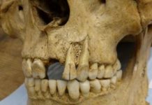 Research: Research on British teeth unlocks potential for new insights into ancient diets —