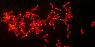 Study: Scientists discover a mechanism of drug resistance in breast and ovarian cancer — (Details)