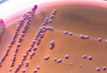 Research: Bacterial armor could be a new target for antibiotics —