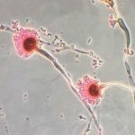 Study: Chemists characterize the fatal fungus among us — (Details)